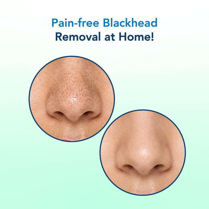 Korean Glass Skin Essence Nose Strips 20 Pcs Pack of 2